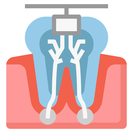 root-canal_5